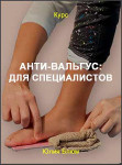 Анти-вальгус: тренинг для специалистов