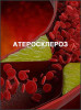 Атеросклероз