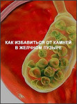 Как избавиться от камней в желчном пузыре
