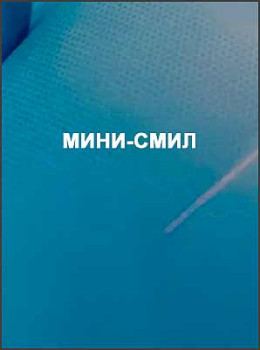 Мини-СМИЛ