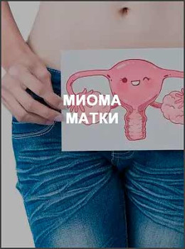Миома матки