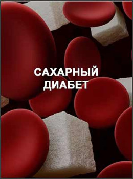 Сахарный диабет