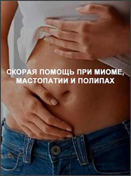 Скорая помощь при миоме, мастопатии и полипах