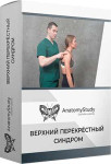 Верхний перекрестный синдром